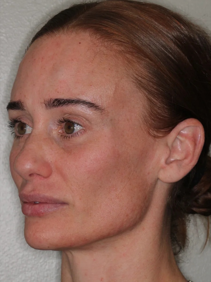 A result from Advanced Dentistry and Aesthetics