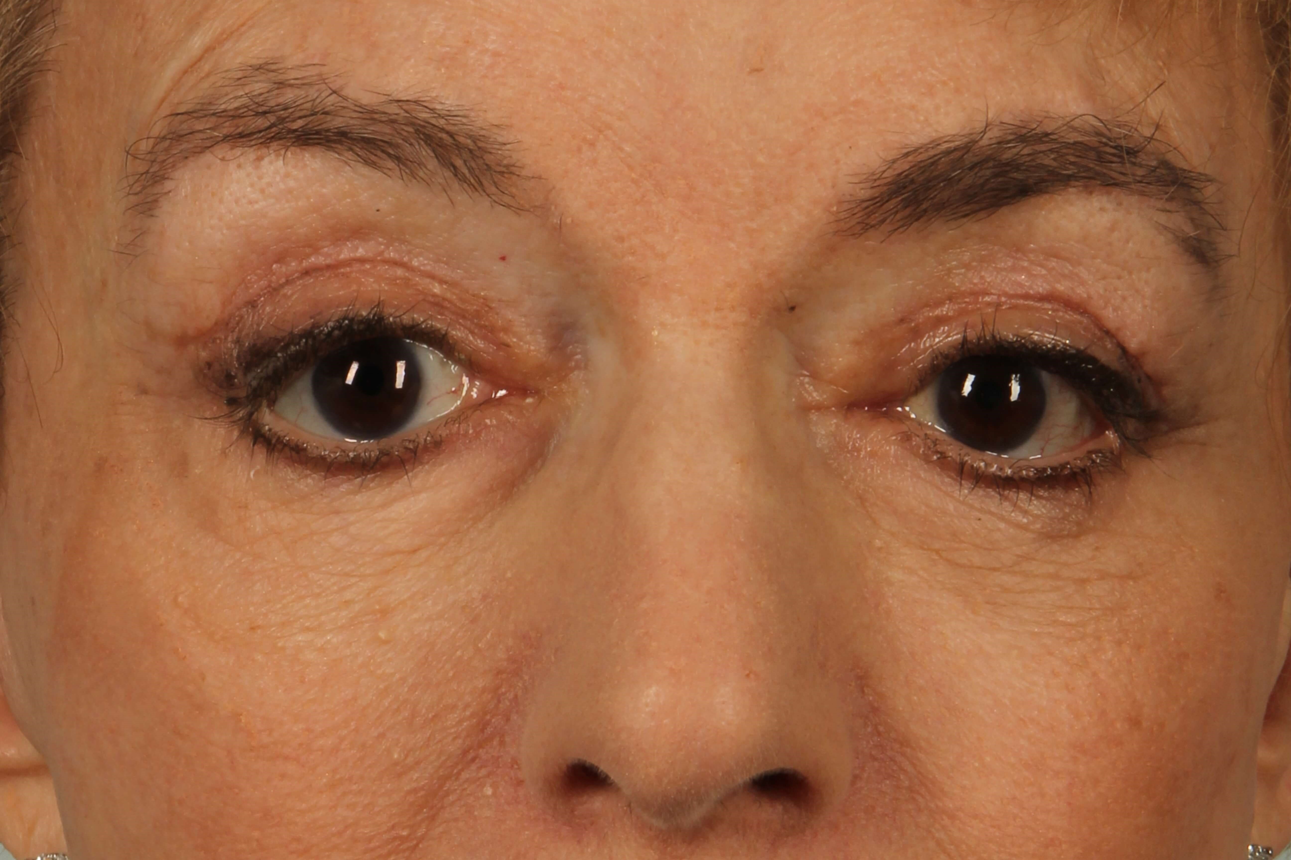 A result from Alan B. Brackup, MD