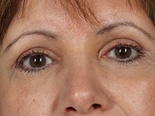 A result from Alan B. Brackup, MD