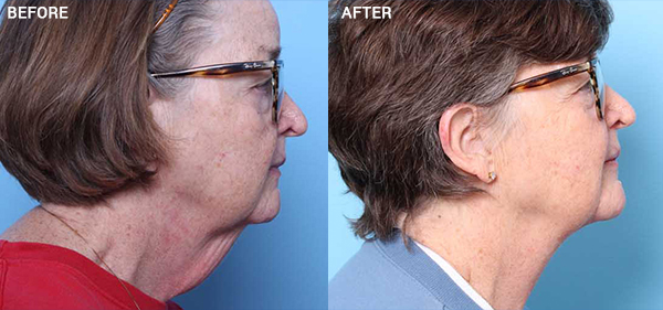 Nebraska Medicine Village Pointe Aesthetic Surgery | Dreams MedSpa provider photo