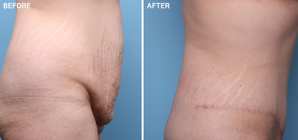 Nebraska Medicine Village Pointe Aesthetic Surgery | Dreams MedSpa provider photo
