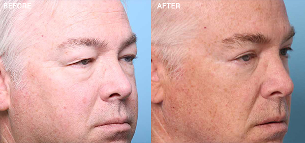 Nebraska Medicine Village Pointe Aesthetic Surgery | Dreams MedSpa provider photo