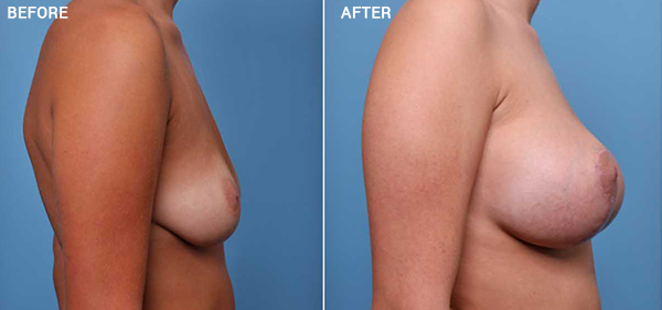 Nebraska Medicine Village Pointe Aesthetic Surgery | Dreams MedSpa provider photo
