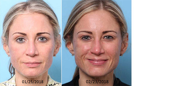 Nebraska Medicine Village Pointe Aesthetic Surgery | Dreams MedSpa provider photo