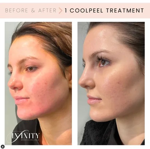 A result from Infinity MedSpa and Wellness