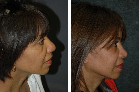 A result from Andrew Jacono, MD