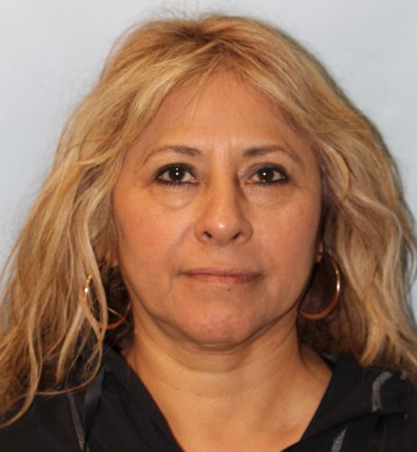 Blepharoplasty before photo