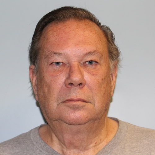 Blepharoplasty before photo