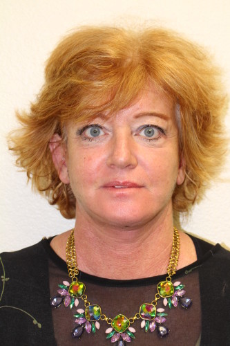 A result from Richards Cosmetic Surgery