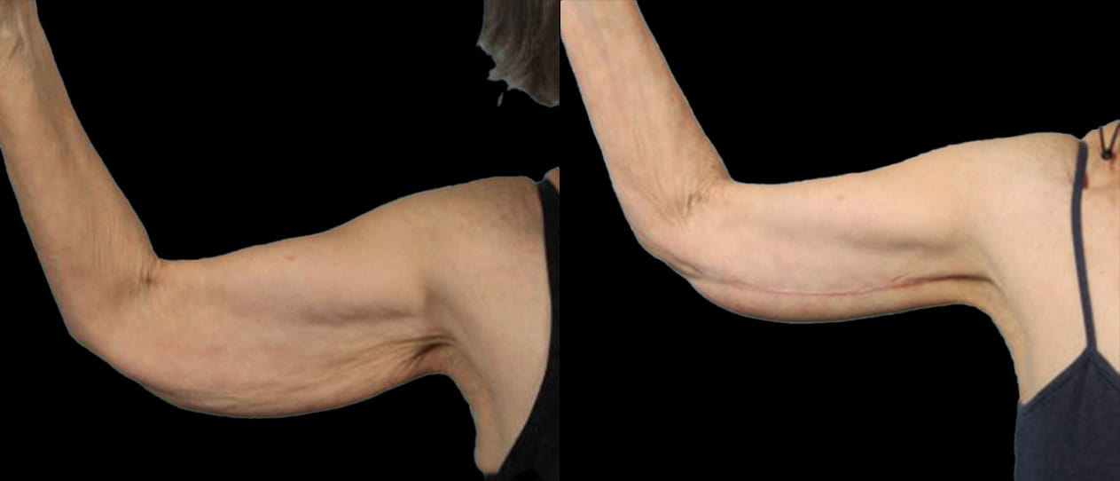 A result from Marietta Plastic Surgery