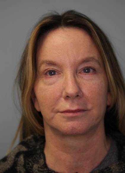 A result from Jonathan Pontell, MD
