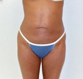 A result from Elias Gikas, MD