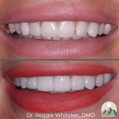A result from Roy Dental Care