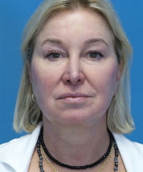 A result from Crispin Plastic Surgery