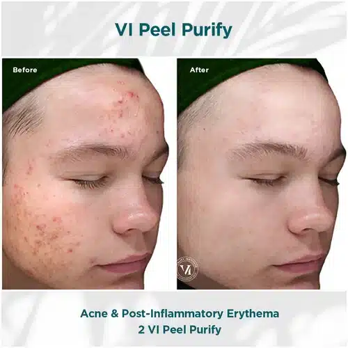 A result from Bella Medspa