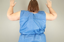 A result from Utah Cosmetic Surgery