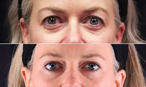 A result from Joyce Aycock, MD