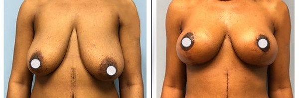 Dr. Binh Nguyen, MD, Board Certified Plastic Surgeon provider photo