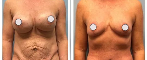 Dr. Binh Nguyen, MD, Board Certified Plastic Surgeon provider photo
