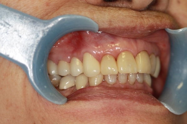 A result from Harder Dental: Drs. Harder, Pham & Associates