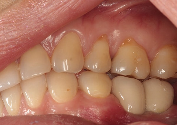 A result from Harder Dental: Drs. Harder, Pham & Associates