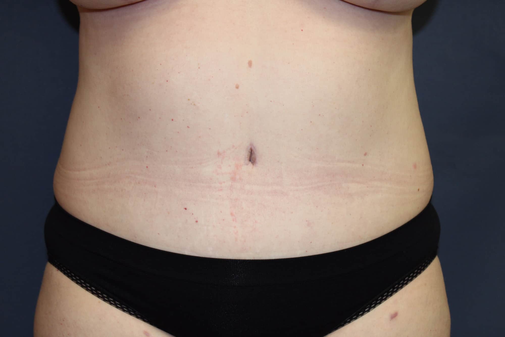 A result from Dr. David Bray Jr.