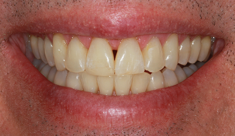 A result from Nashville Restorative Dentistry