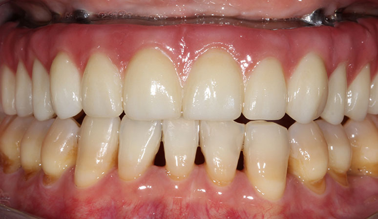 A result from Nashville Restorative Dentistry