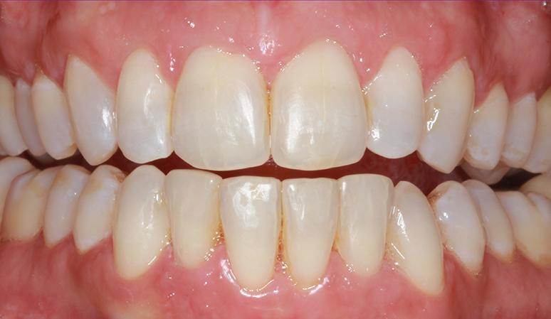 A result from Nashville Restorative Dentistry