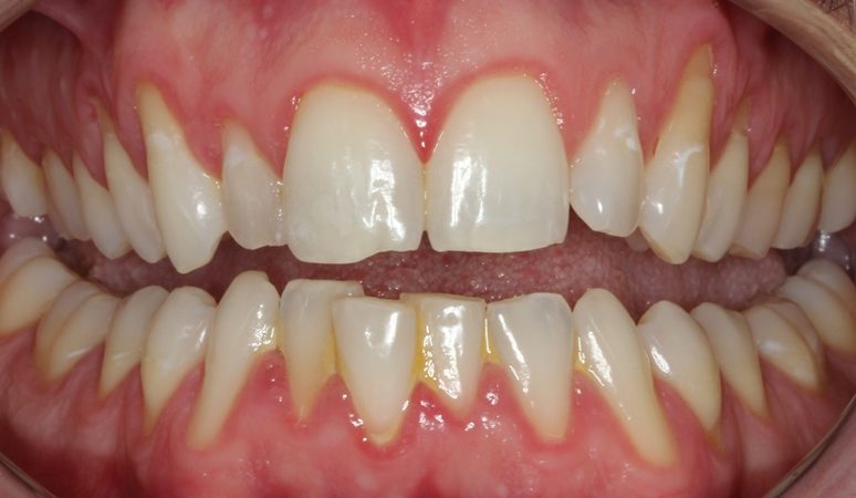 A result from Nashville Restorative Dentistry