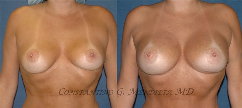 4 Beauty Aesthetics Institute for Plastic Surgery: Dr. Constantino Mendieta provider photo