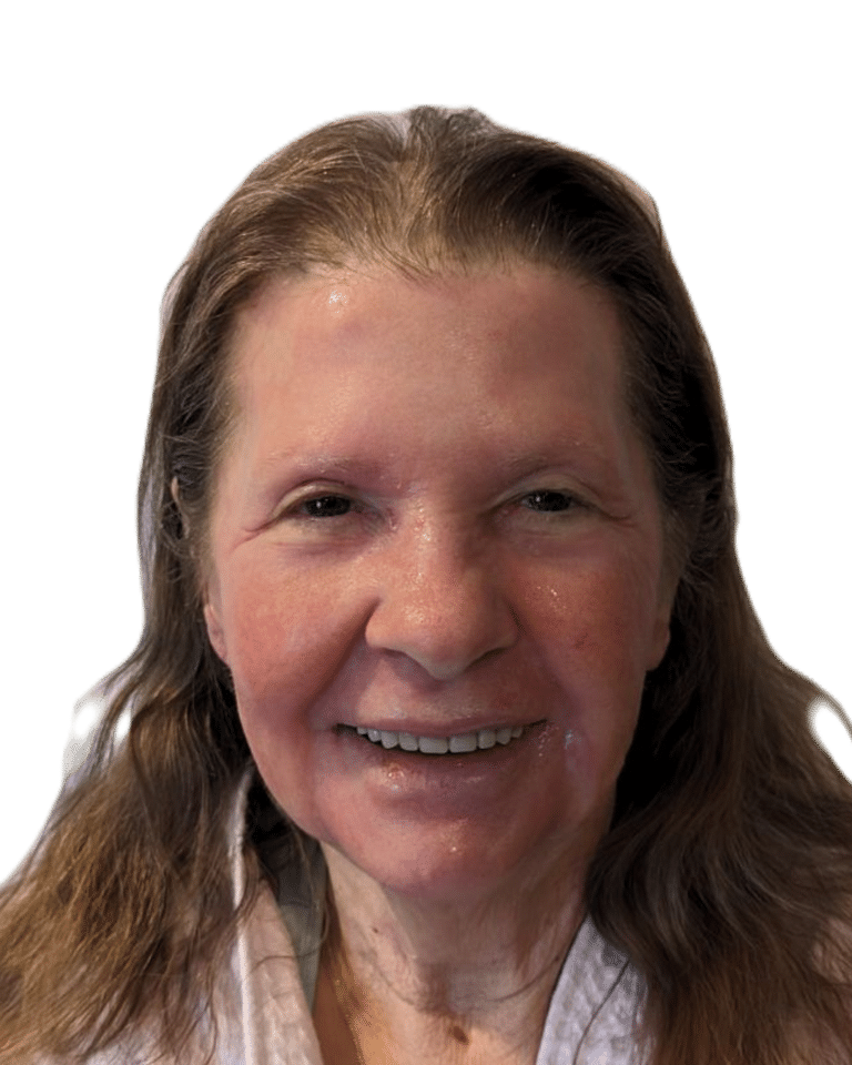 Chemical Peel before photo
