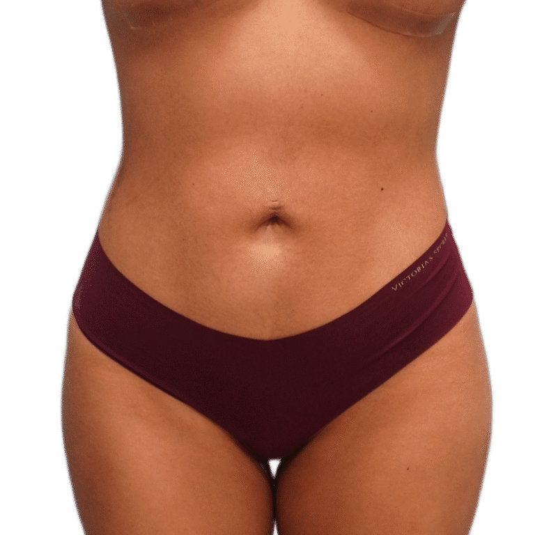 A result from Envision Cosmetic Surgery