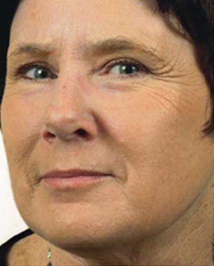A result from Plastic Surgery Specialists