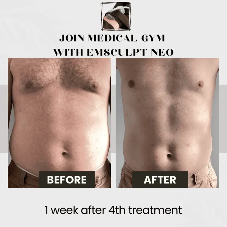 Hair Restoration result at Optimal Health Family Practice & Medspa