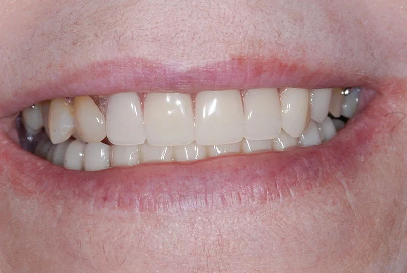 A result from My Dentist in Plano