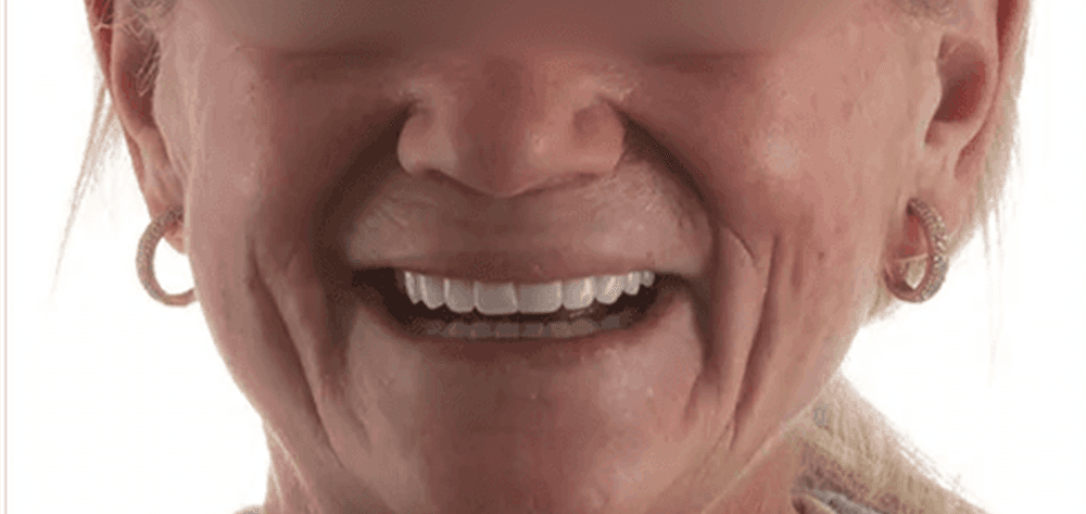 A result from Dental Design Studios (Dentista)