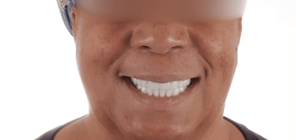 A result from Dental Design Studios (Dentista)