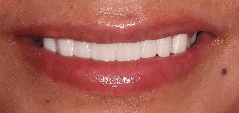 A result from Dental Design Studios (Dentista)