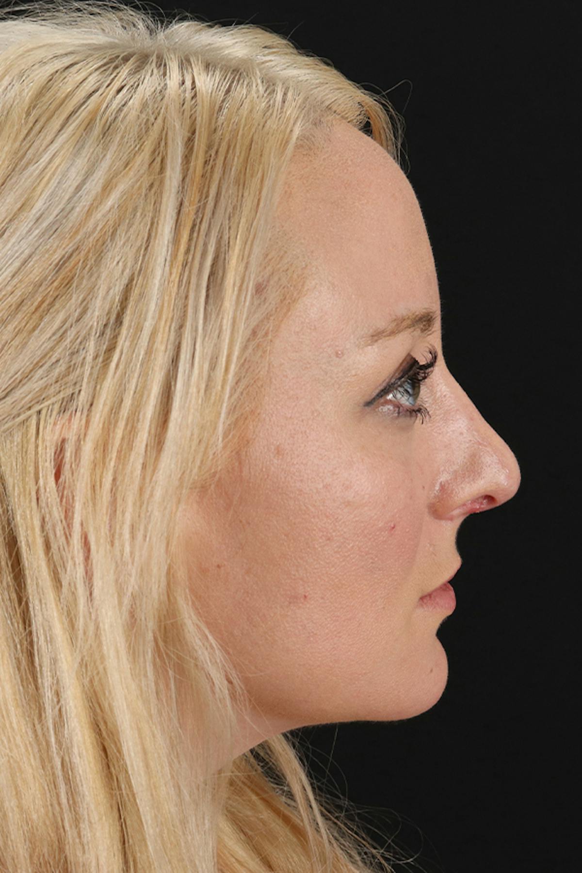 A result from Dr. Courtney