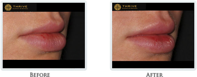 A result from Thrive Aesthetic & Wellness