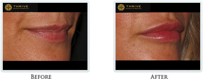 A result from Thrive Aesthetic & Wellness