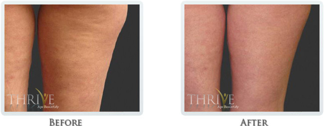 Thrive Aesthetic & Wellness provider photo