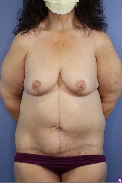 A result from Michael Howard, MD