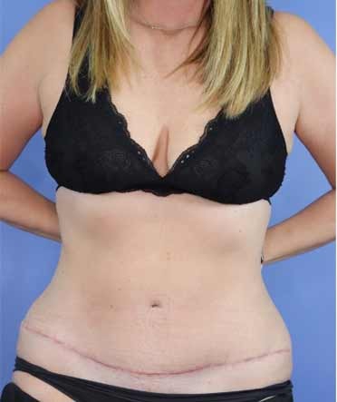 A result from Michael Howard, MD