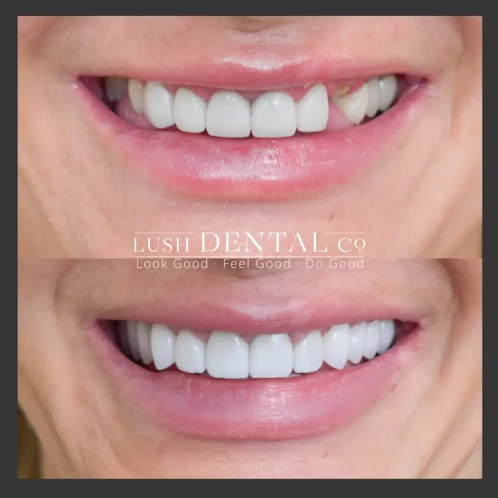 A result from Lush Dental Co.