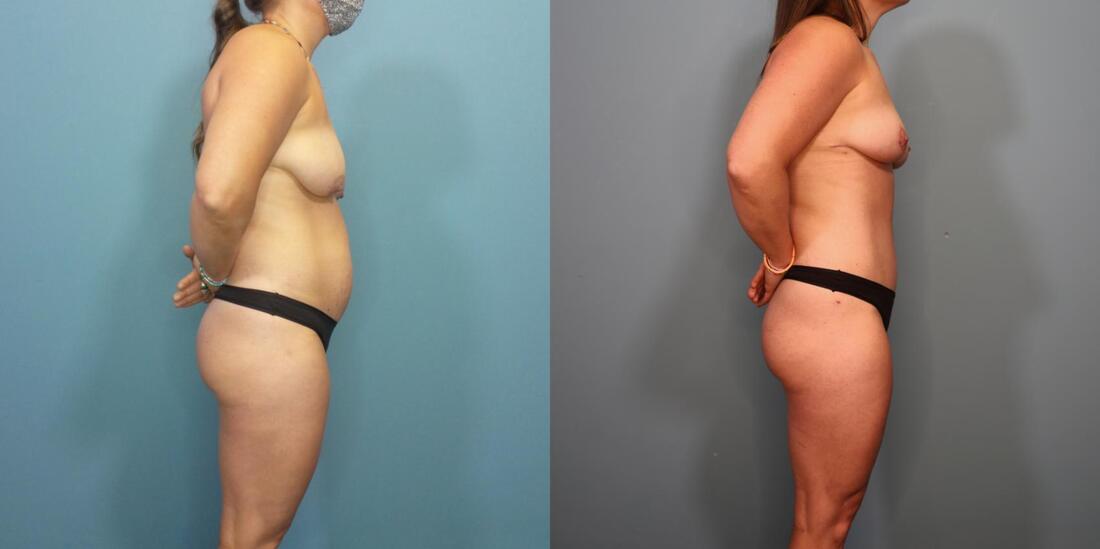 A result from Austin Hayes, MD