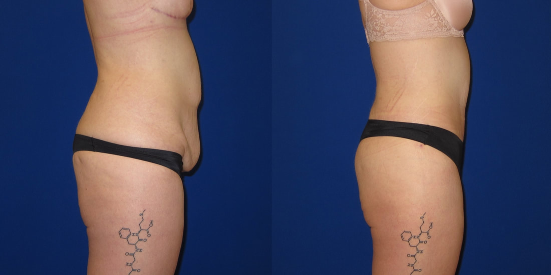 A result from Austin Hayes, MD