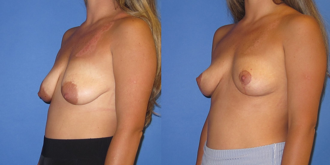 A result from Austin Hayes, MD