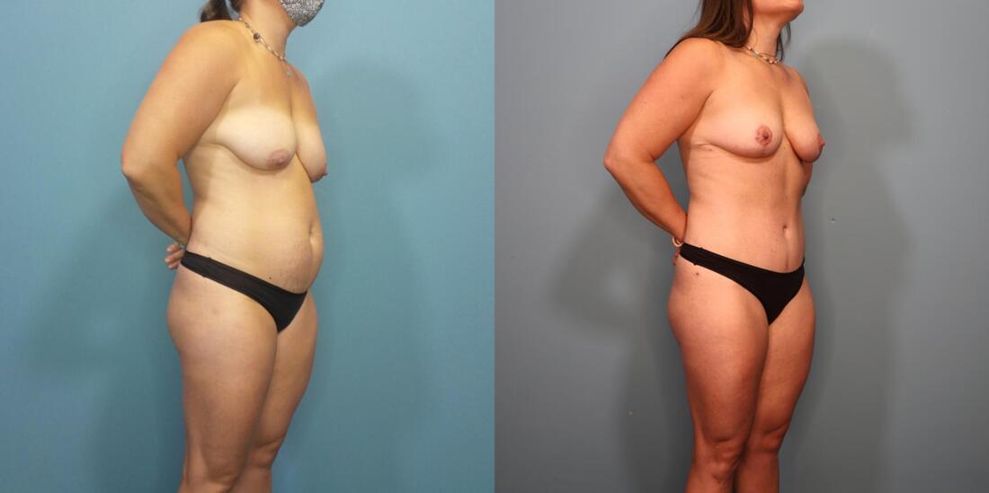 A result from Austin Hayes, MD